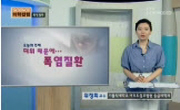 더위 때문에...폭염질환