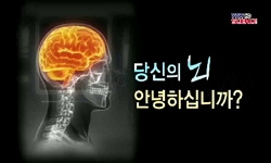 <다큐S+>당신의 뇌는 안녕하십니까?