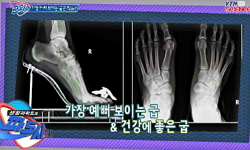 가장 예뻐보이는 굽은 몇 cm?