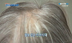 탈모가 빨라진다!